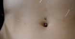 acupuncture_abdomen1s